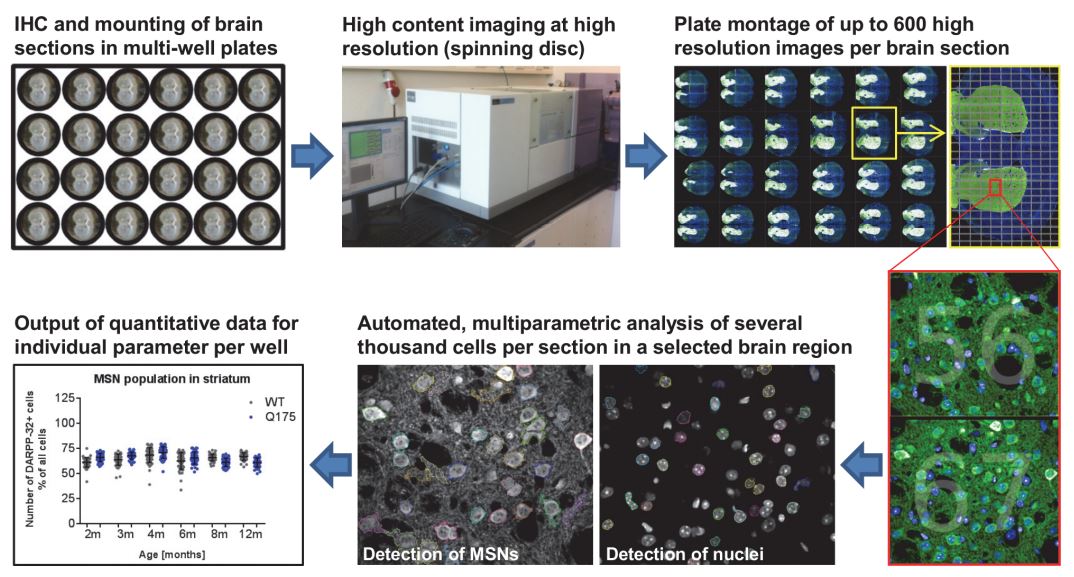 Fig.1 Workflow of high content imaging for ex vivo phenotypic characterization. (Nikisha, C.; et al. 2015)
